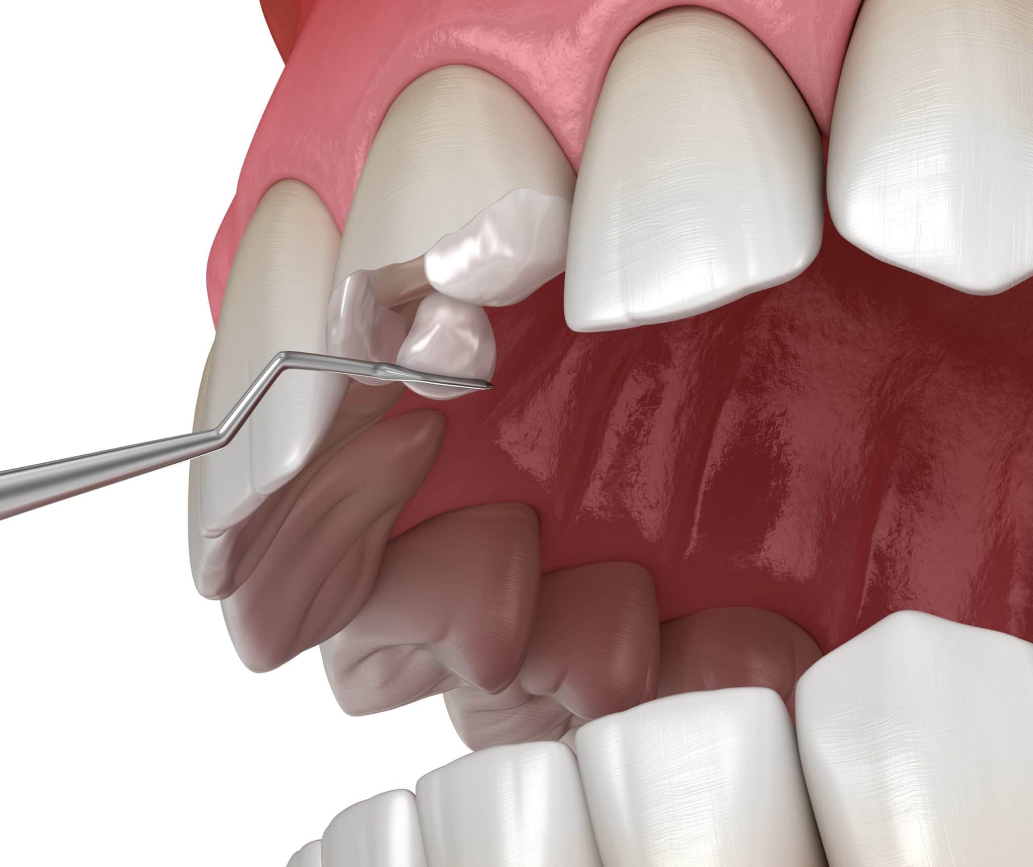 how does a general dentist protect more than just your teeth?